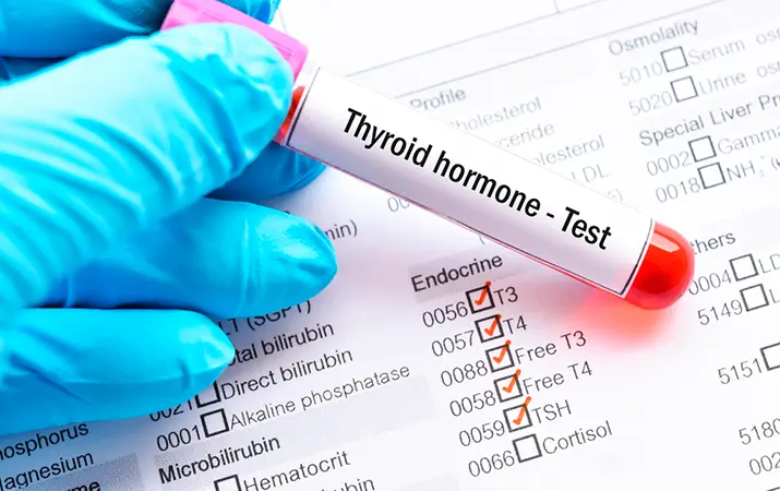 Определения гормонов в эндокринологической практике