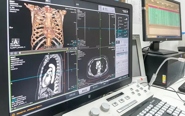 chongqing chinamay 7 2020 doctor analysis test result from mri scaner computer covid 19 pandemic