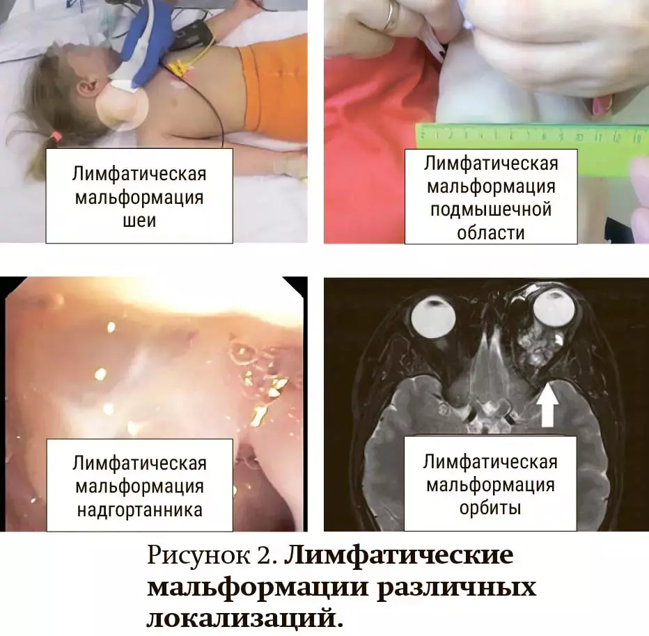 cxfd5445vg 1