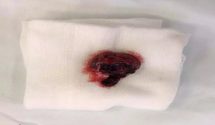 ris6 14 gigapixel low resolution 2x