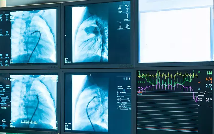 xray monitor screen