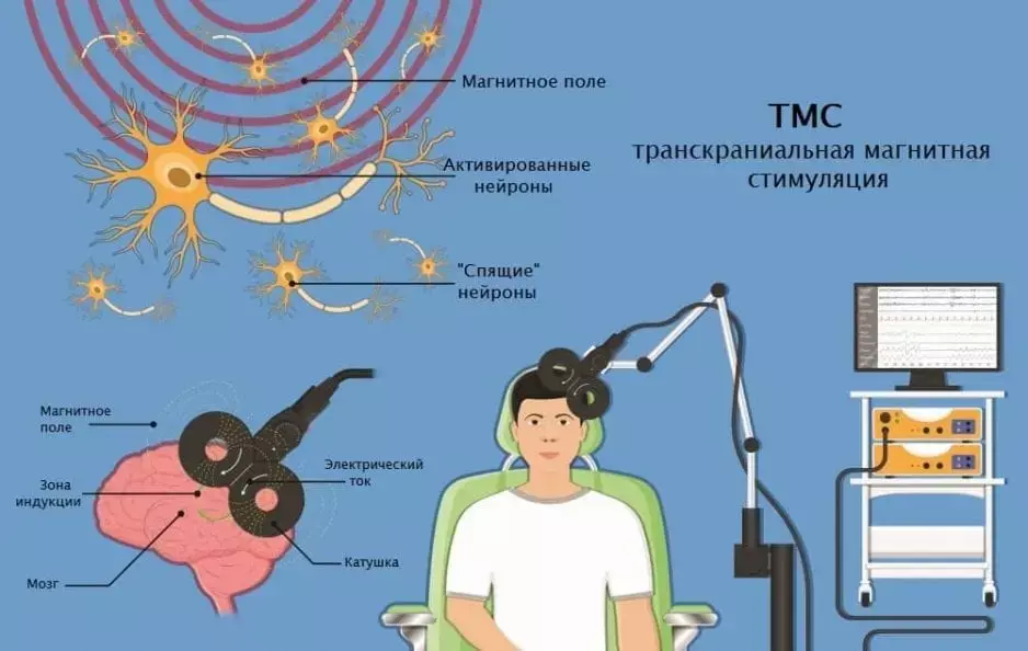 shema transkranialnoj magnitnoj stimuljacii 938x594 1